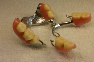 Partial Denture2